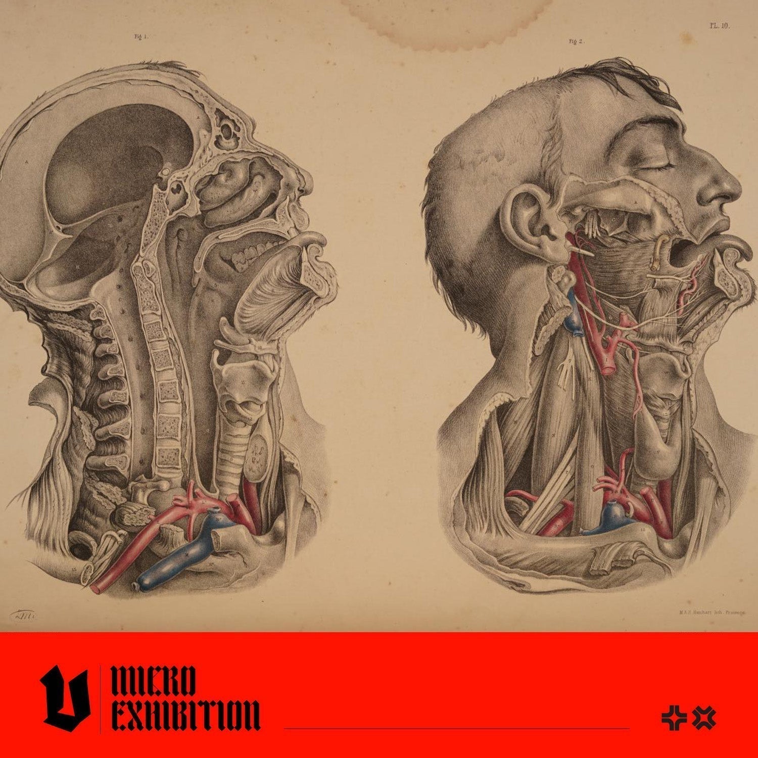 Why Joseph Maclise's 'Surgical Anatomy' Changed Medical Illustration