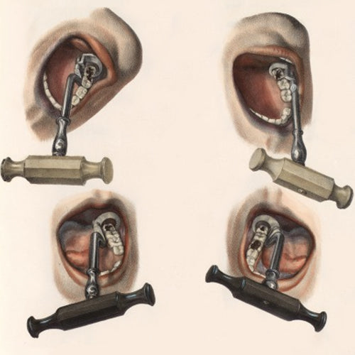 Toe-curling facts about early dentistry