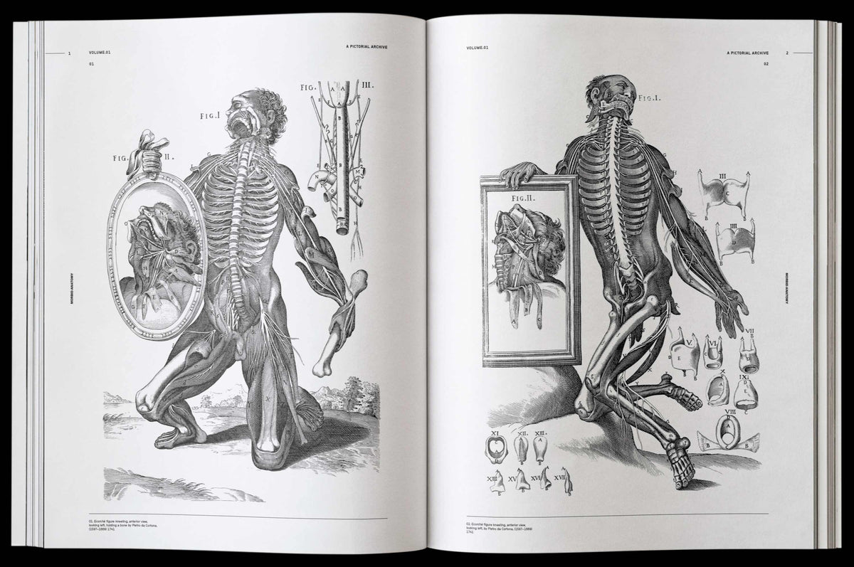 Morbid Anatomy (Digital eBook)